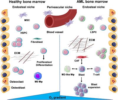 Macrophages in Acute Myeloid Leukaemia: Significant Players in Therapy Resistance and Patient Outcomes